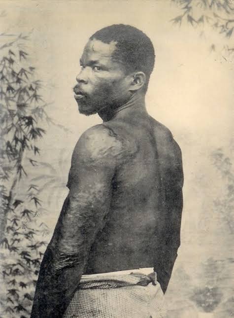 Saint-Pierre Martinique Volcano Eruption Survivor